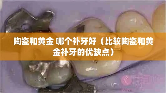 陶瓷和黄金 哪个补牙好（比较陶瓷和黄金补牙的优缺点）