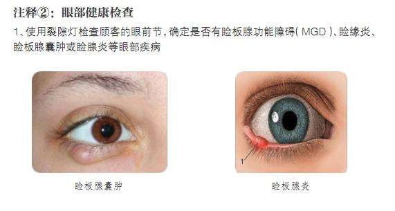 常见的眼部疾病(常见的眼部疾病有哪些都有什么症状)