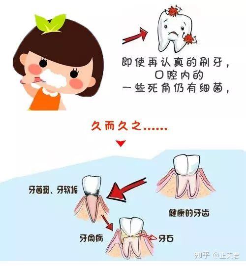 牙齿的疾病(牙齿的疾病有哪些)