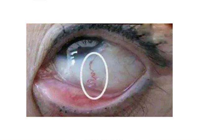 眼部疾病(眼部疾病做什么检查)