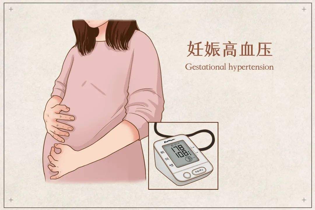 高血压产妇(高血压产妇坐月子的注意事项)