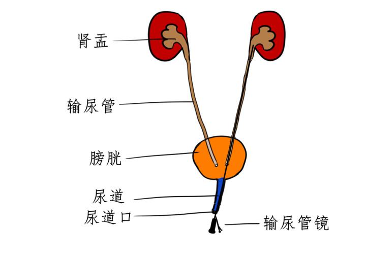 尿道口在哪里(尿道口是哪个部位)