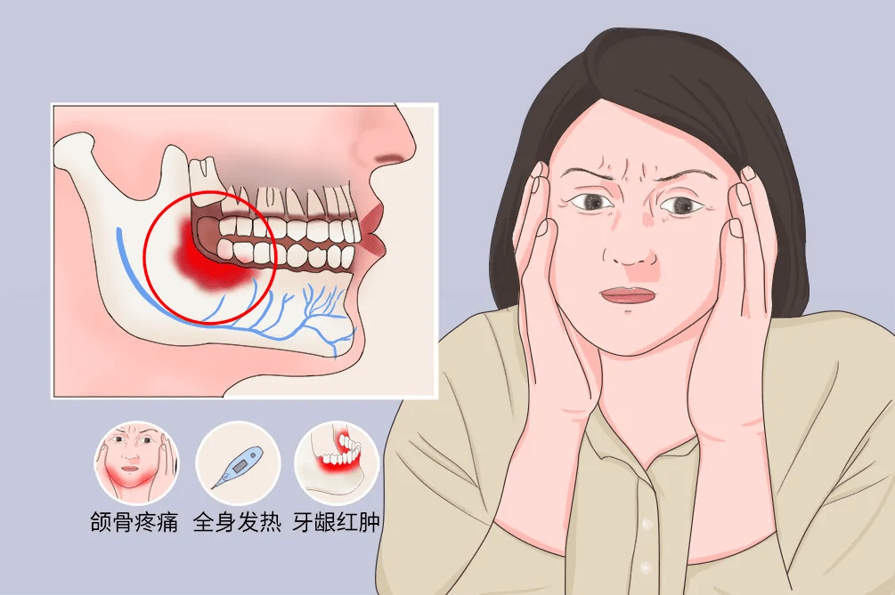 唾液腺疾病(唾液腺疾病ppt)