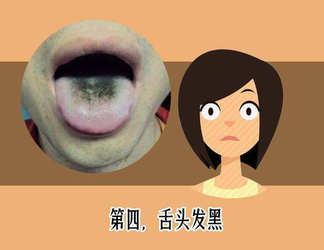 舌头疾病(舌头疾病看什么科)