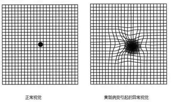 疾病自测(精神心理疾病自测)