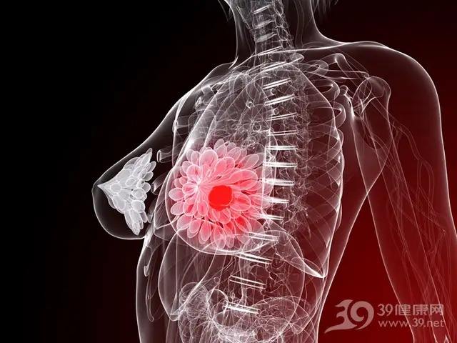 乳腺疾病的症状(乳腺疾病的症状是什么)